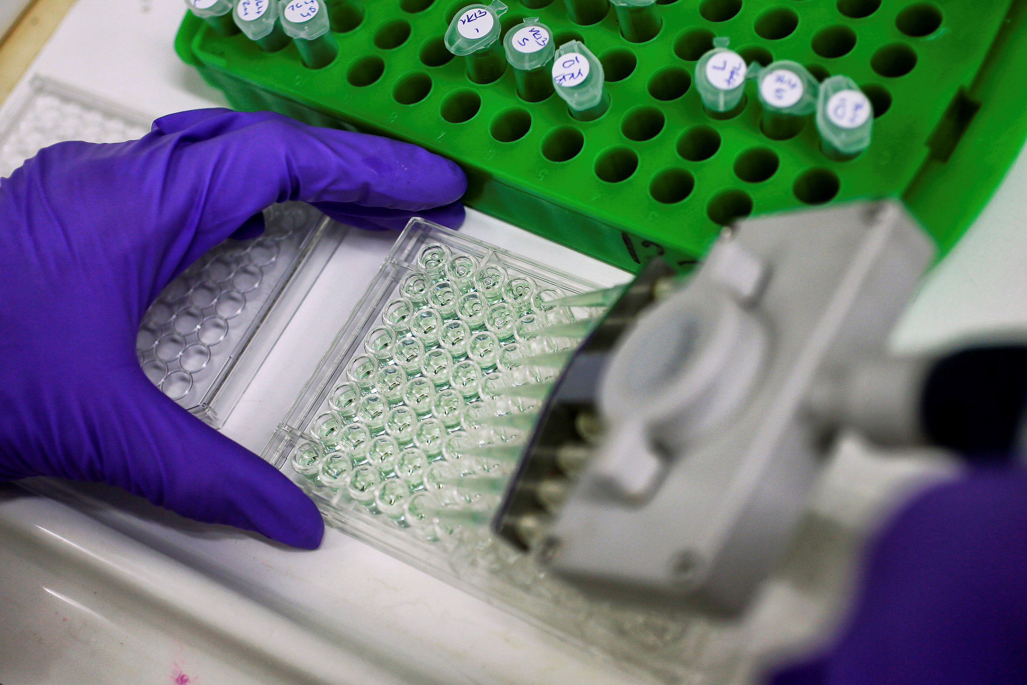 A scientist prepares protein samples for analysis in a lab.