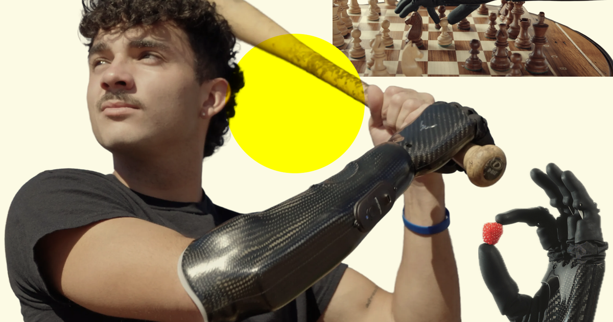Psyonic plans to turn everyday prosthetic-hand use into robot training data
