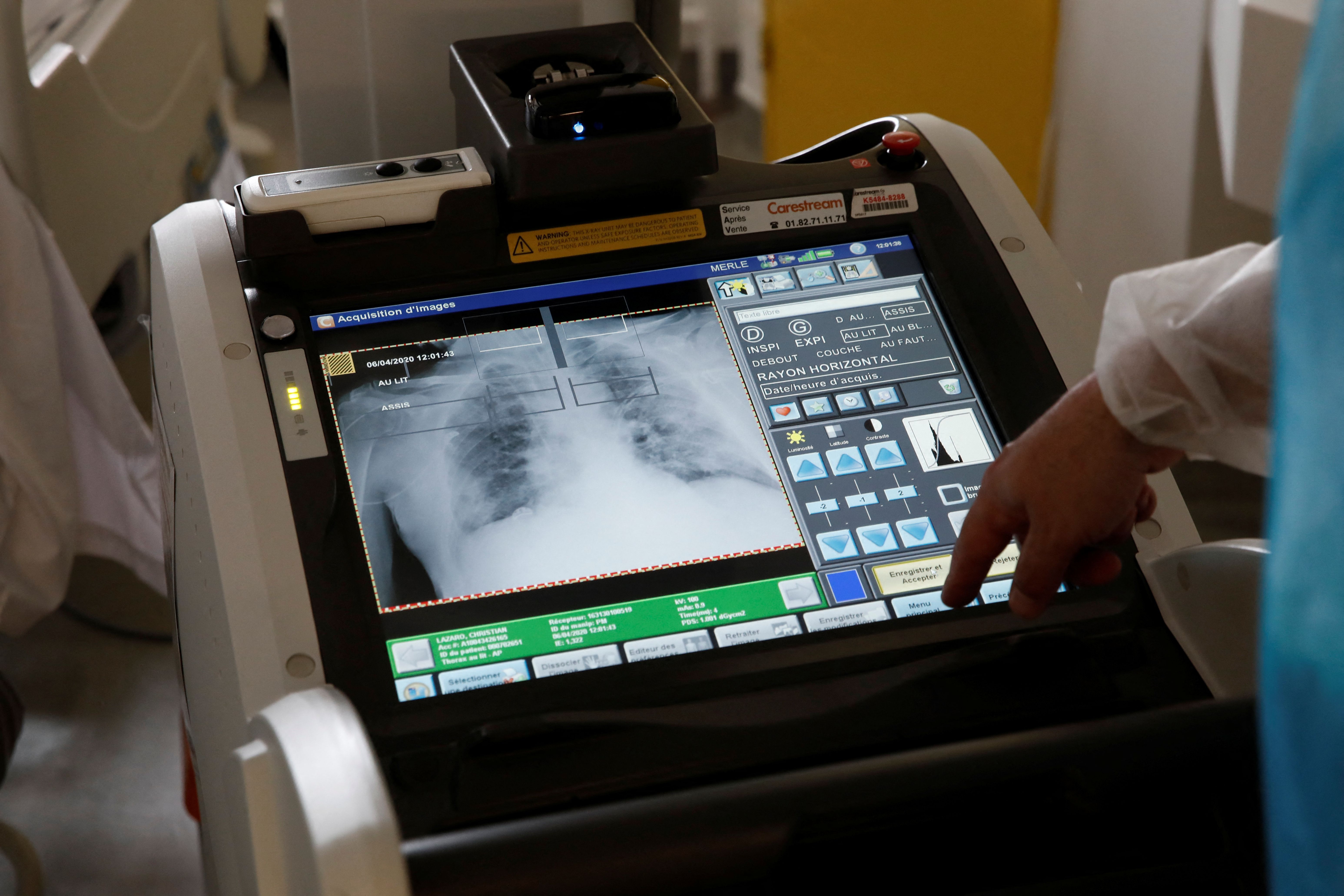 A doctor analyzes an x-ray of lungs
