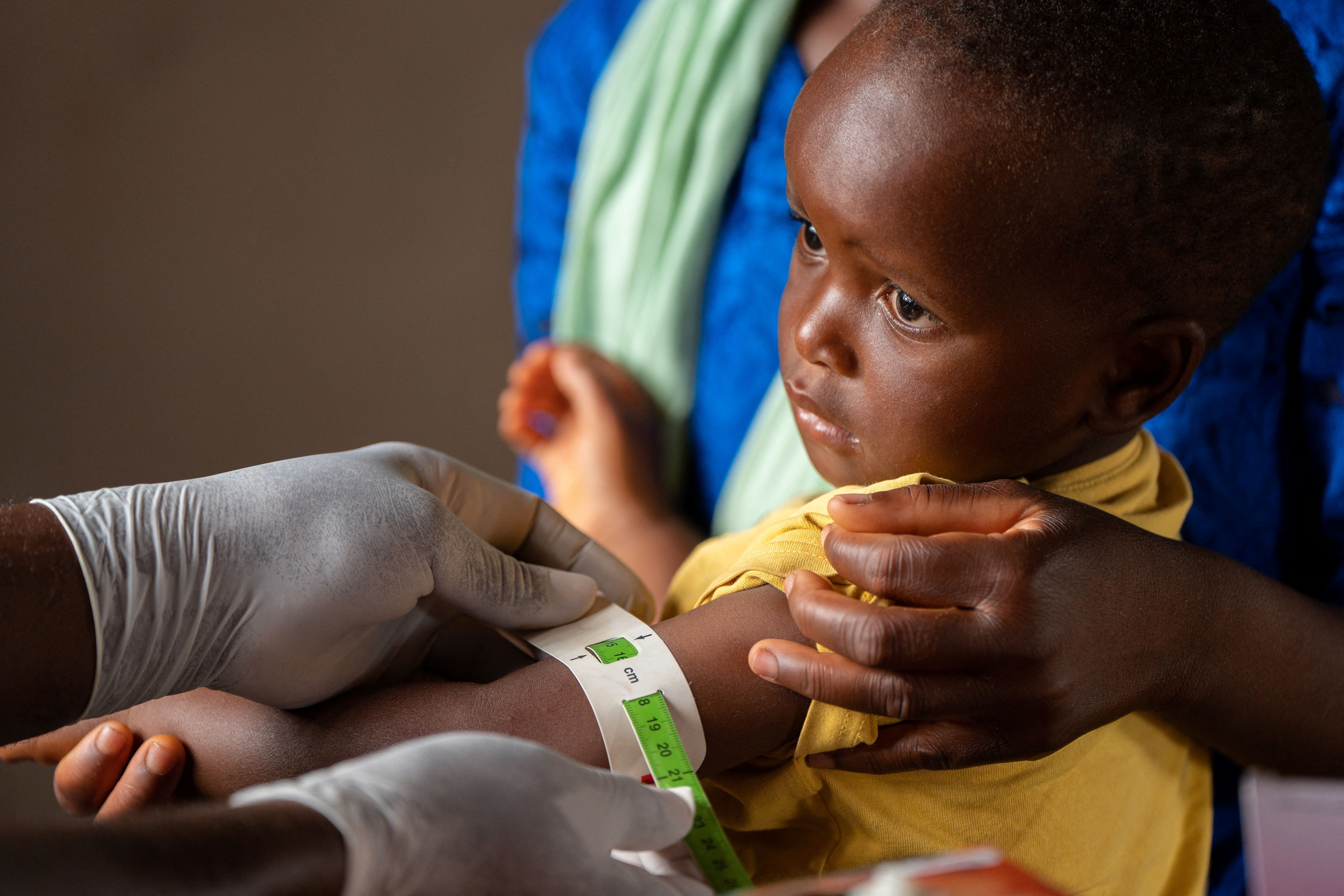 A child tested for nutrition status in Malawi.