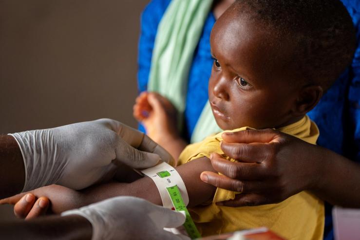 A child tested for nutrition status in Malawi.