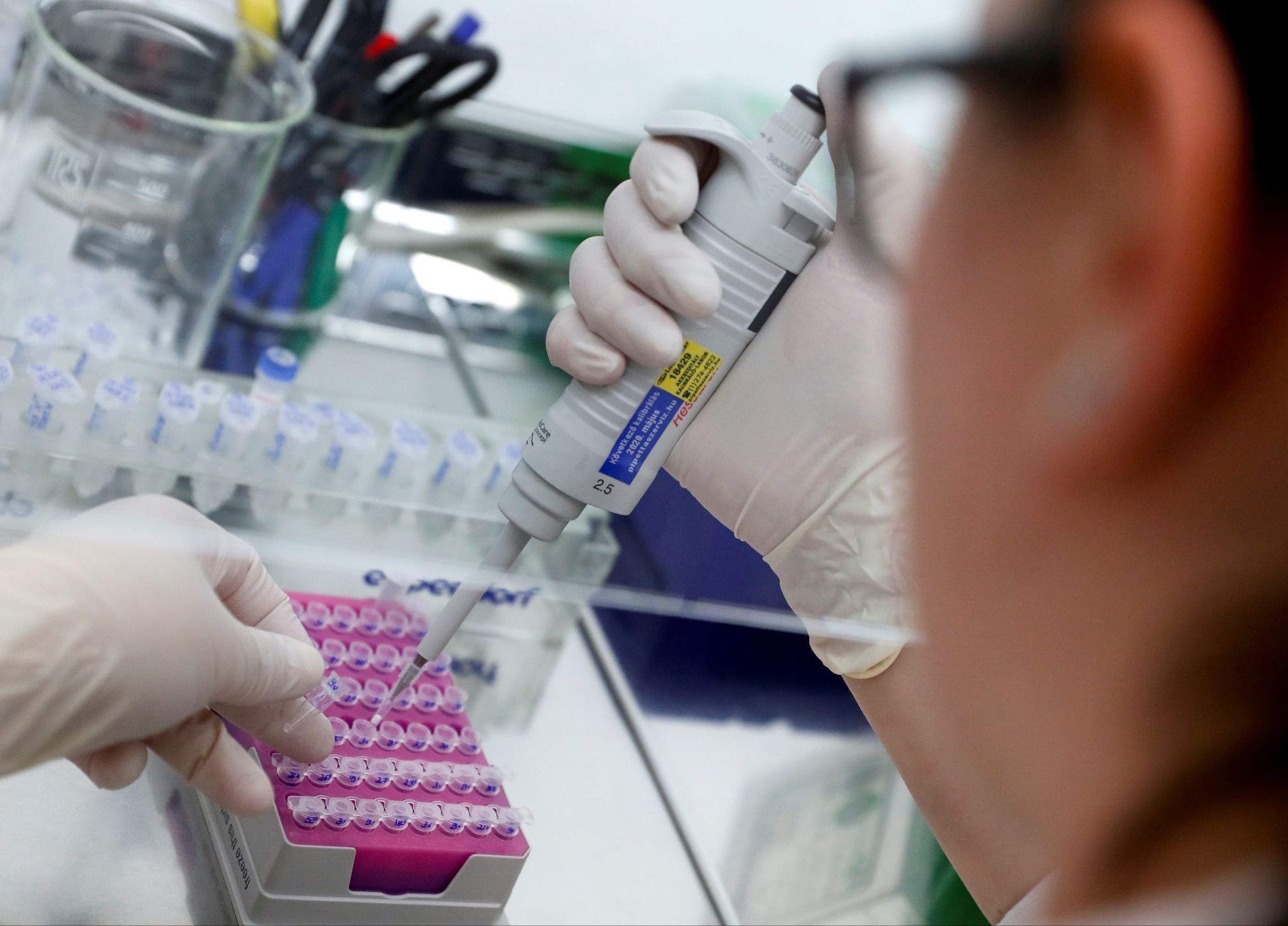A biologist works on DNA extracted from cancer tissue.