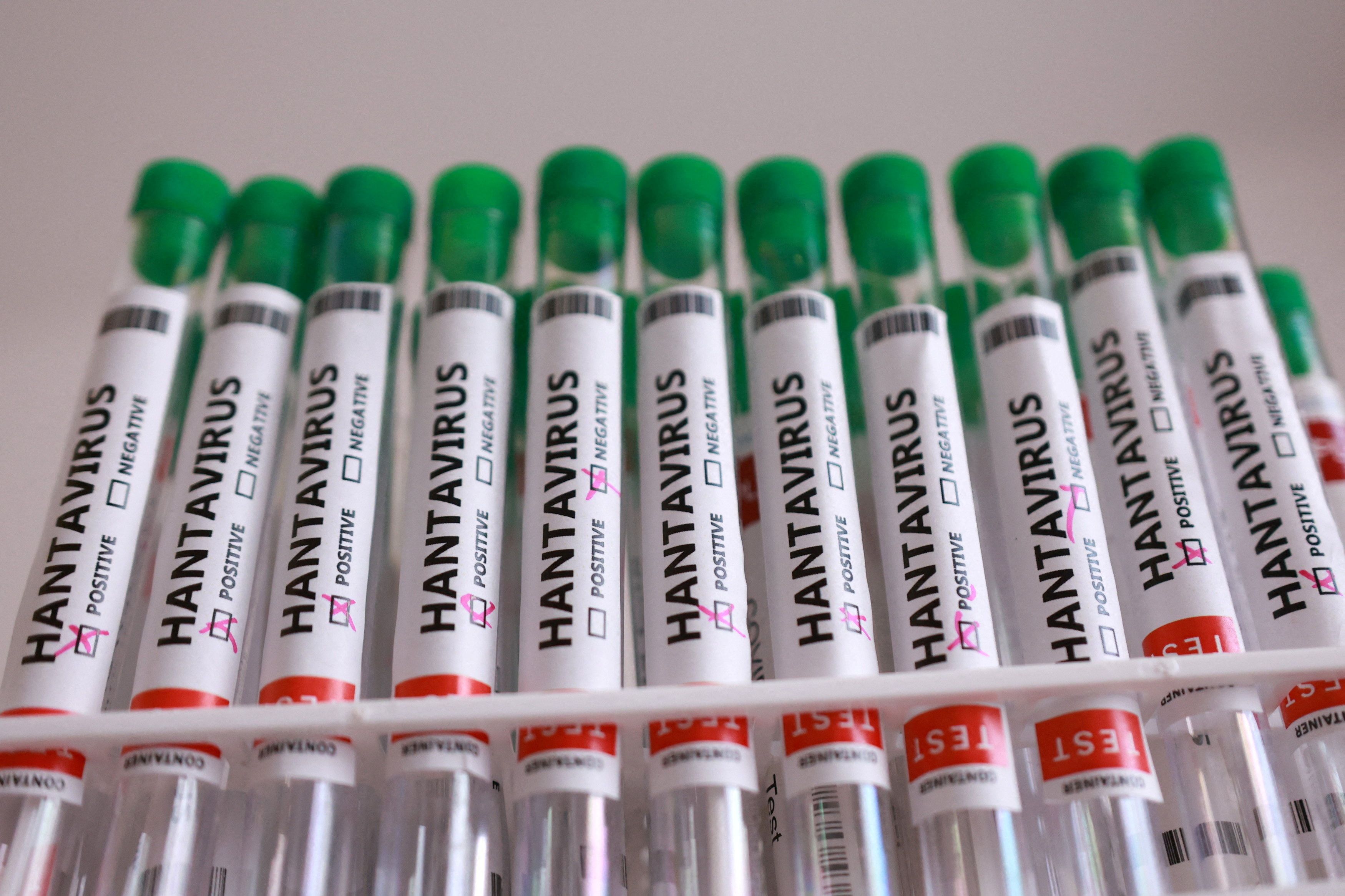 Test tubes labelled “Hantavirus positive” 