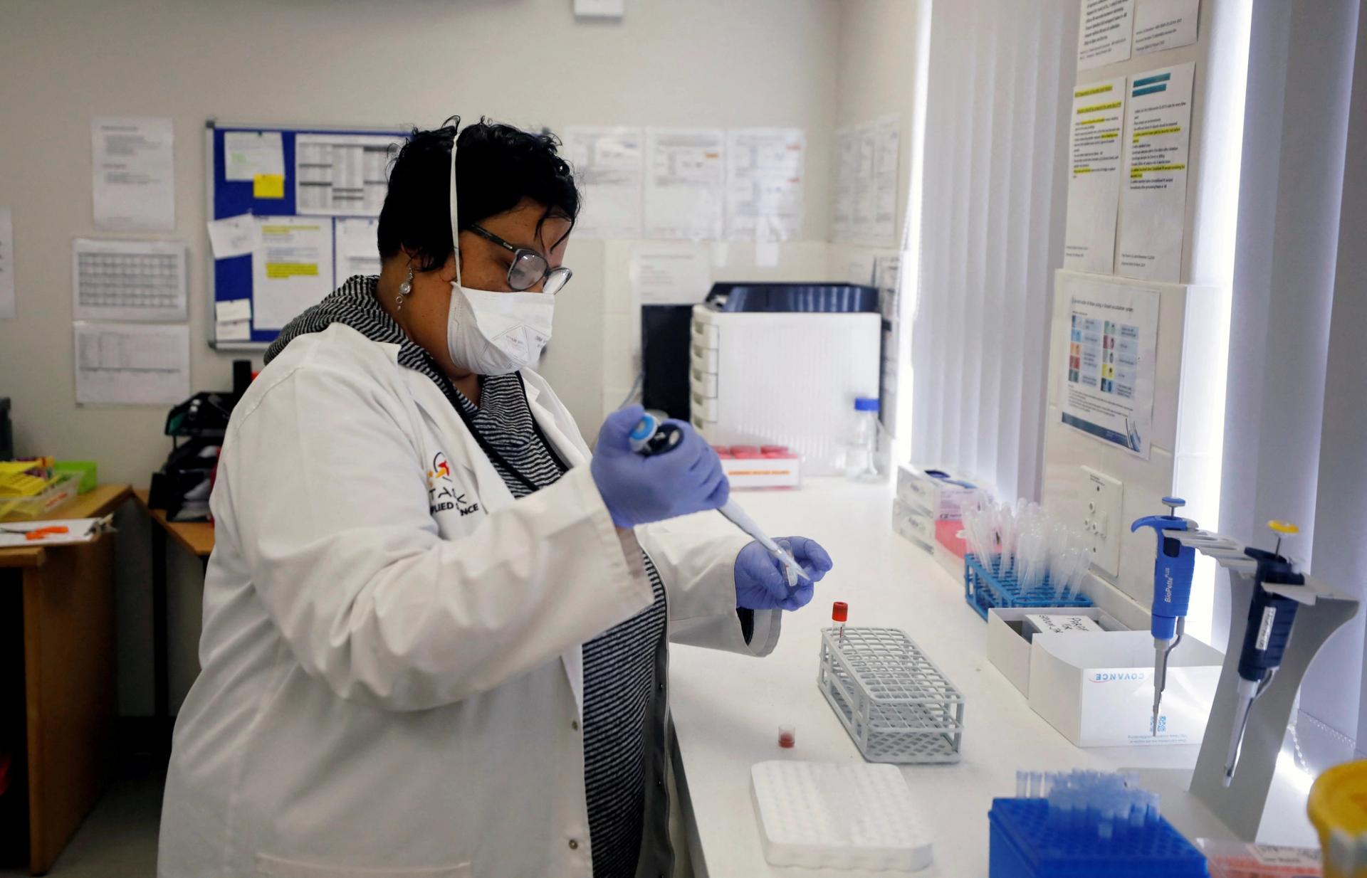 A medical researcher studying the BCG vaccine for tuberculosis examines test samples in a laboratory run by South African biotech company TASK in Cape Town, South Africa, May 11, 2020. Picture taken May 11, 2020. REUTERS/Mike Hutchings
