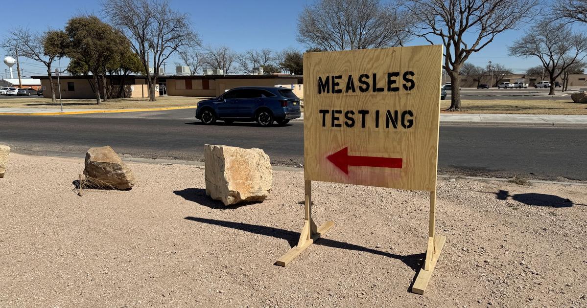 Measles outbreaks spread in US