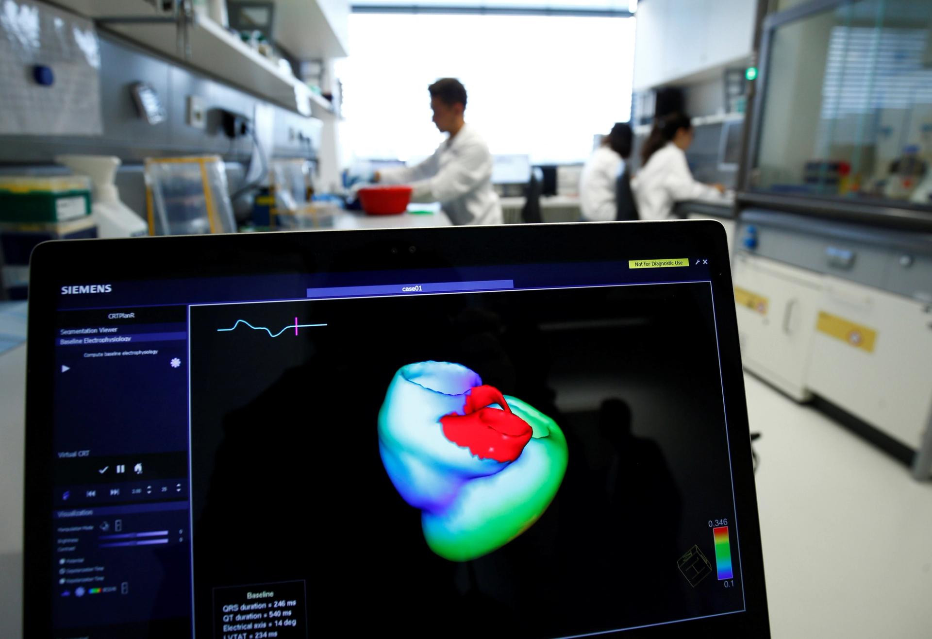 A monitor shows a three-dimensional image of a human heart.