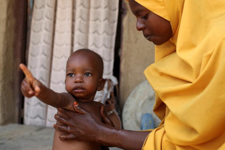 A child sent home from the hospital due to malnutrition in Nigeria