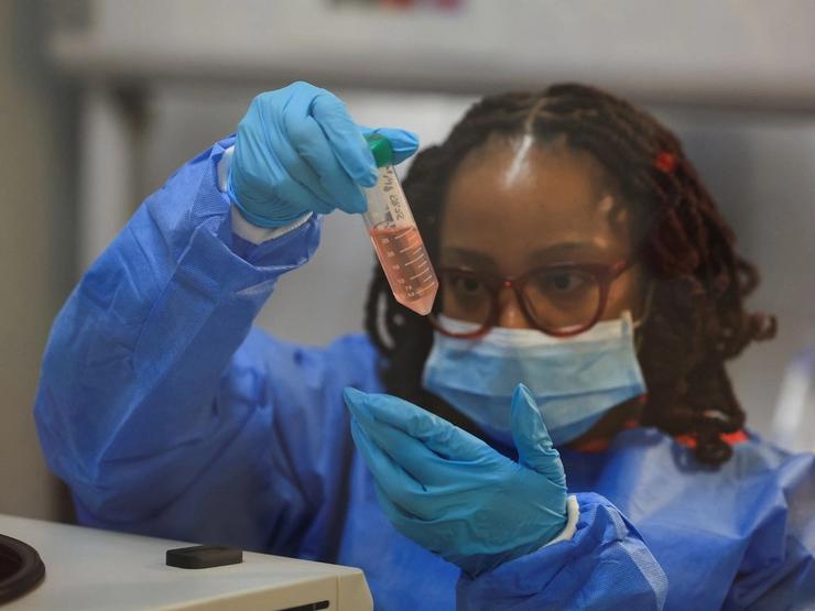Scientific officer Anathi Nkayi works in the research lab at the University of Cape Town’s Institute of Infectious Disease and Molecular Medicine, in Cape Town, South Africa February 17, 2025.