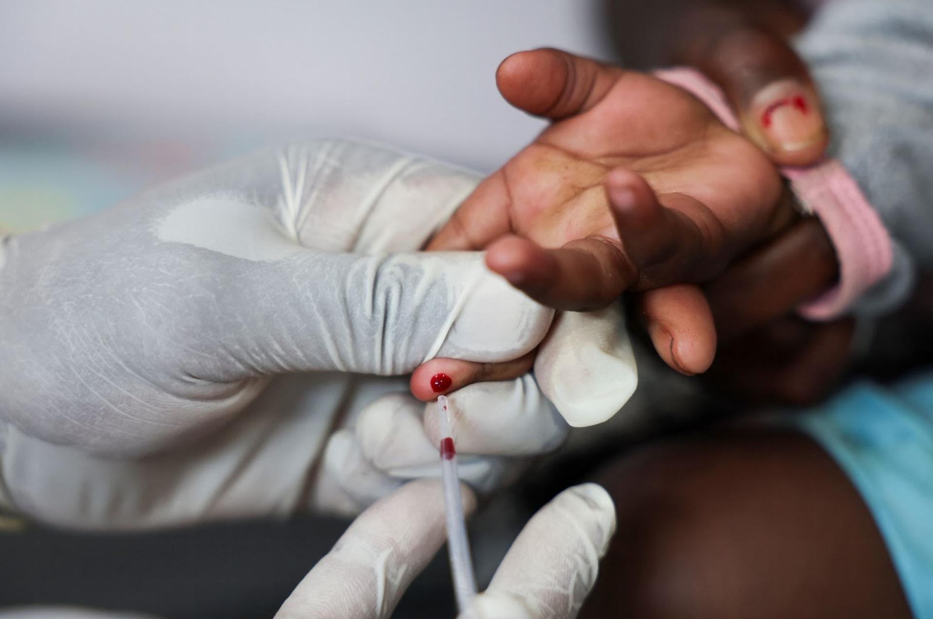A child getting an HIV test in South Africa