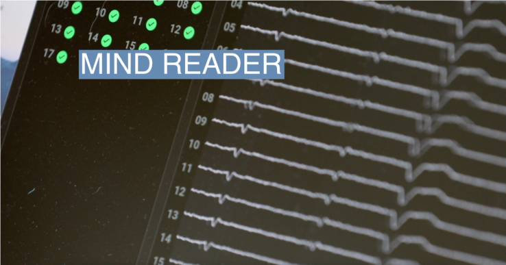 Rodney Gorham’s brain waves are captured by Synchron’s computer-brain interface