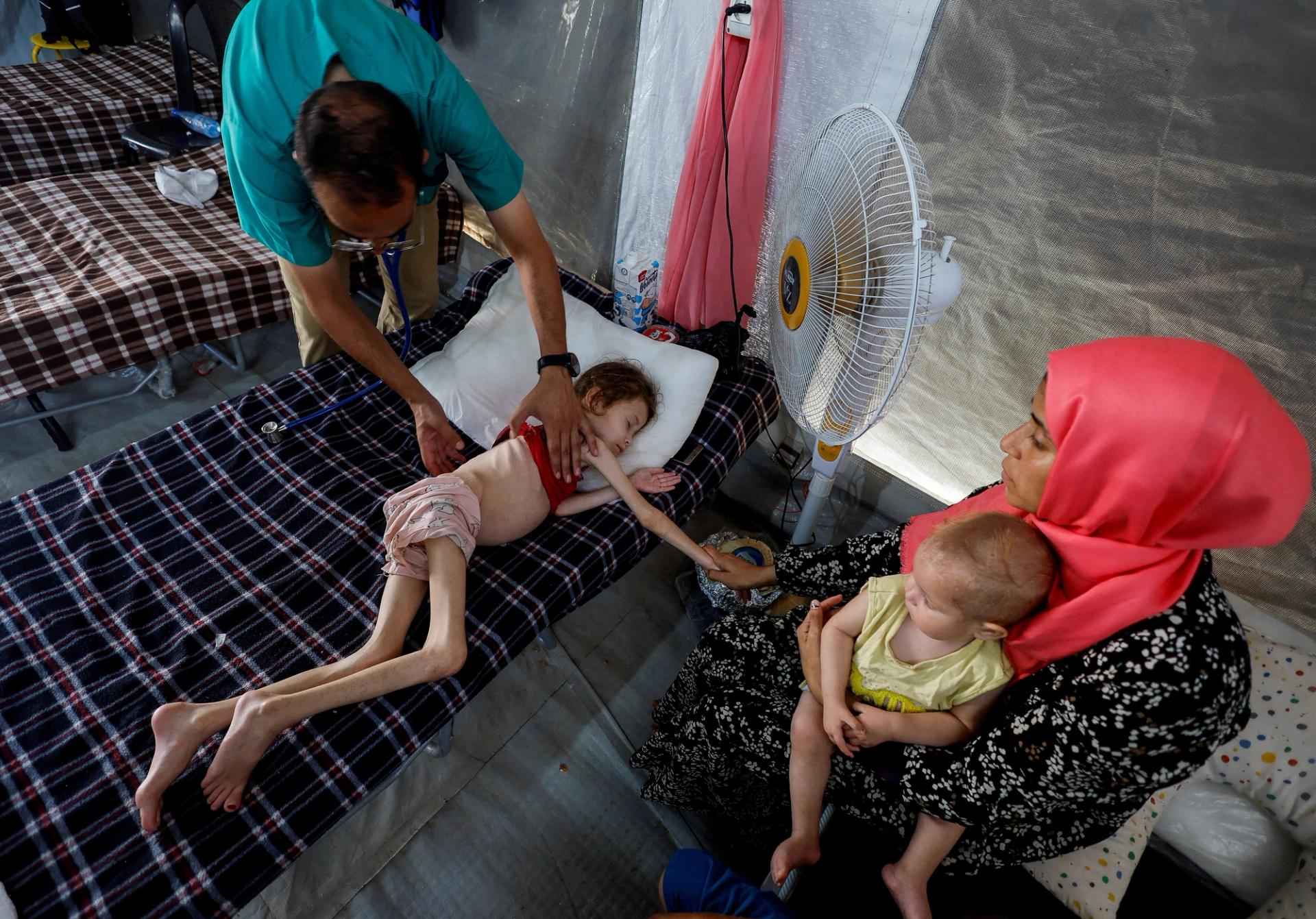 A malnourished child in Gaza. 