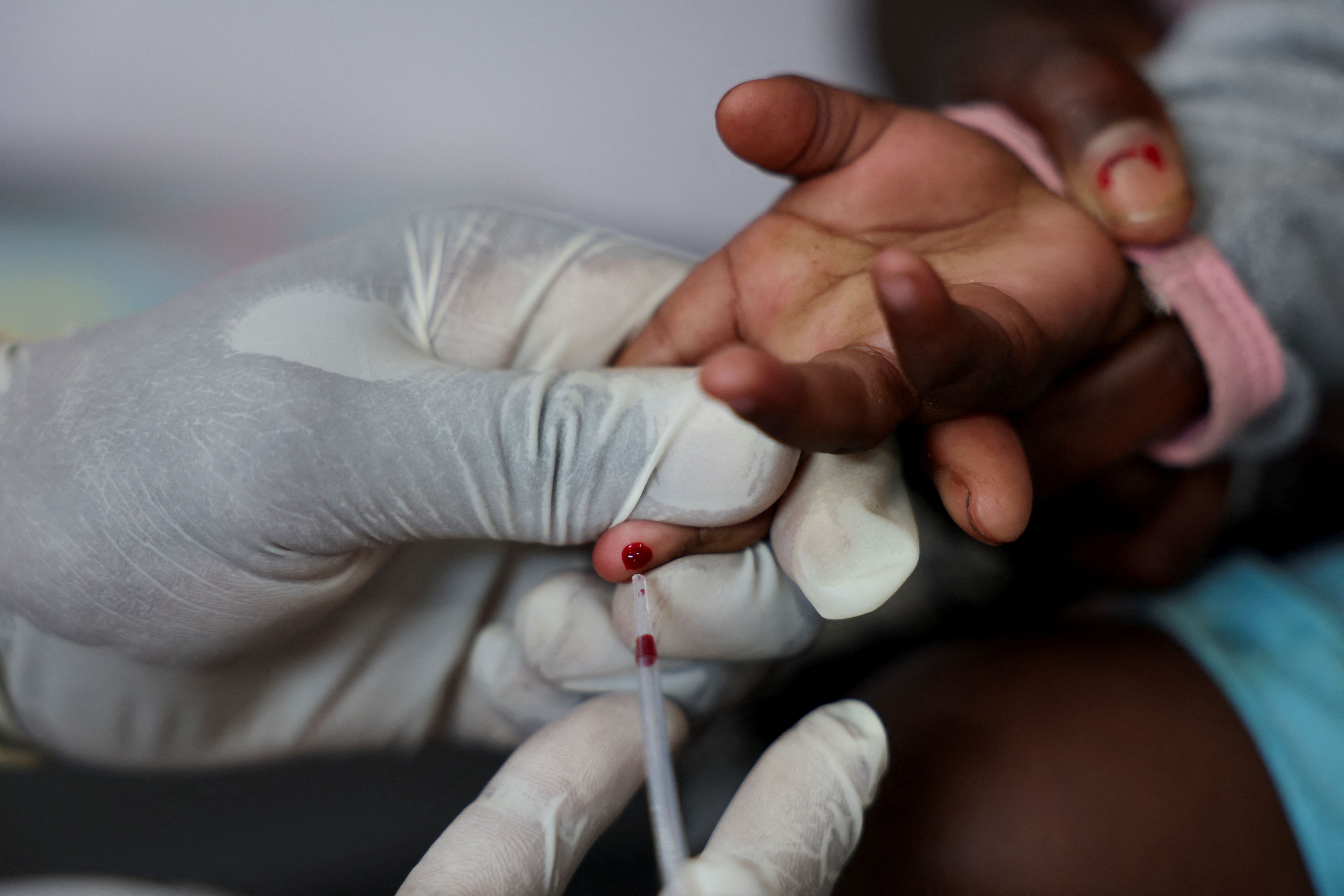 A nurse draws a blood sample from a child for an HIV test.