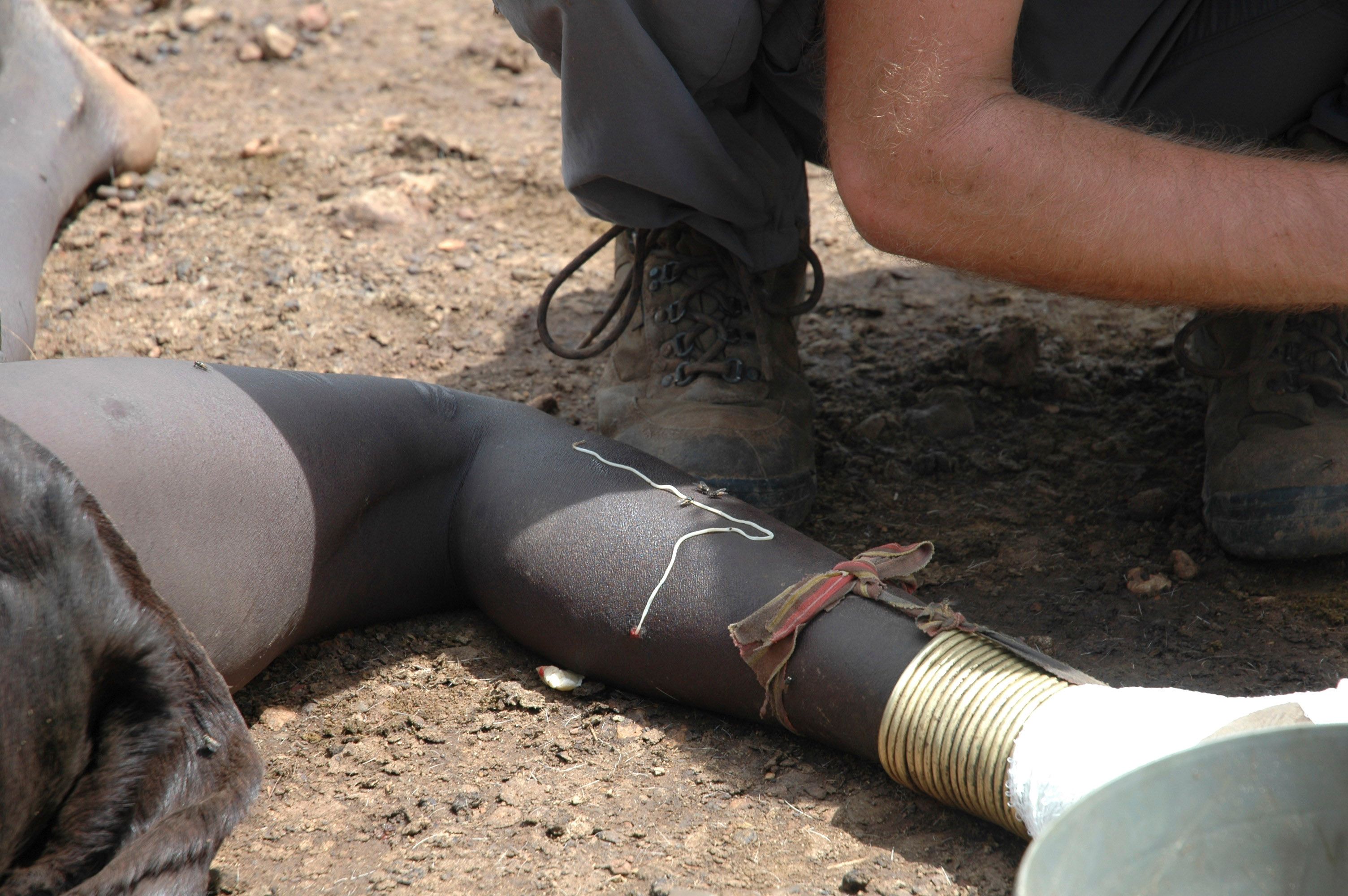 A guinea worm emerges from the leg of a south Sudanese girl.