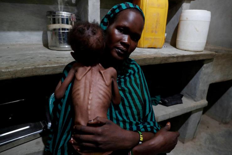 A photo of a severely malnourished child in Sudan.