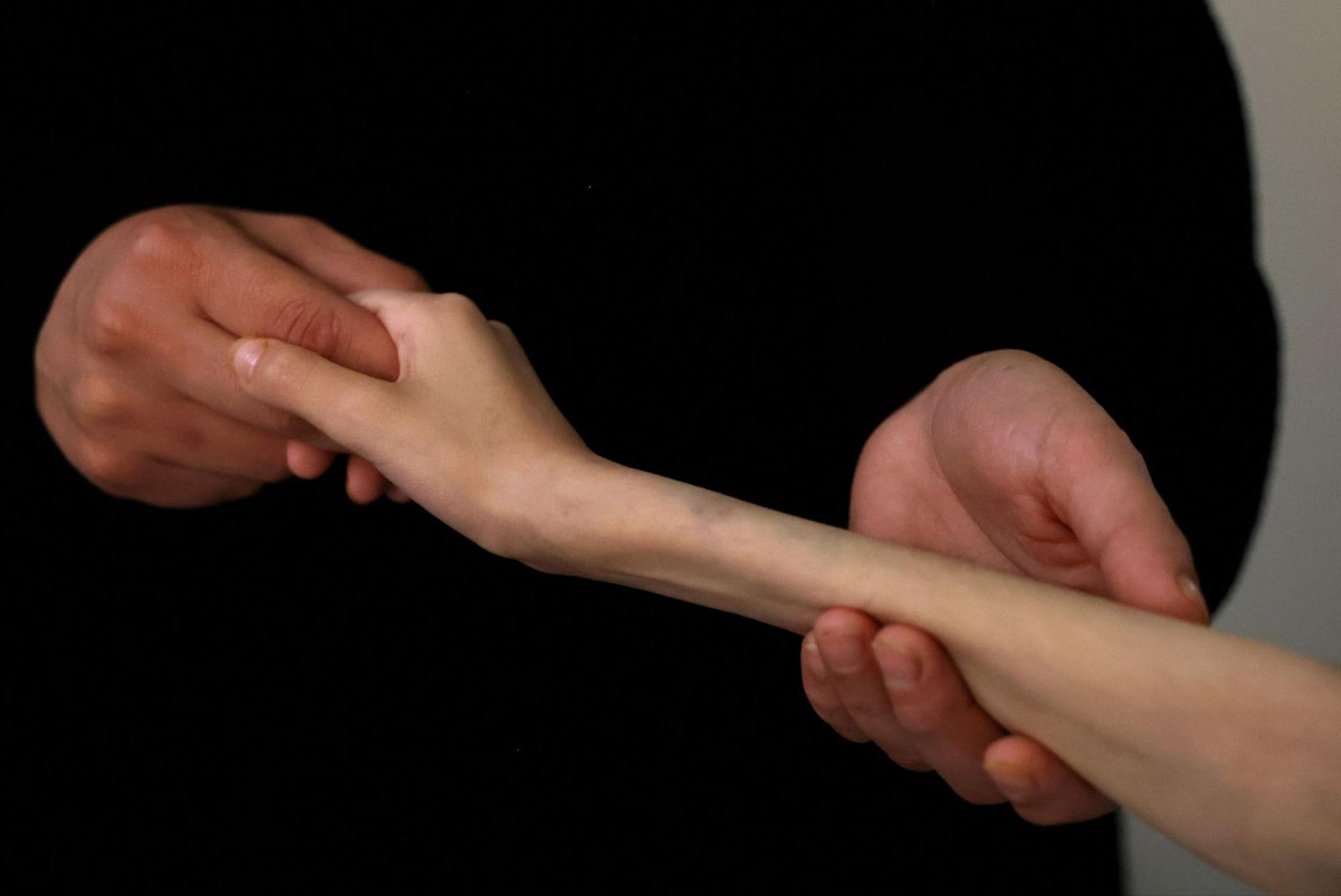 A mother in Gaza holds the hand of her malnourished child.