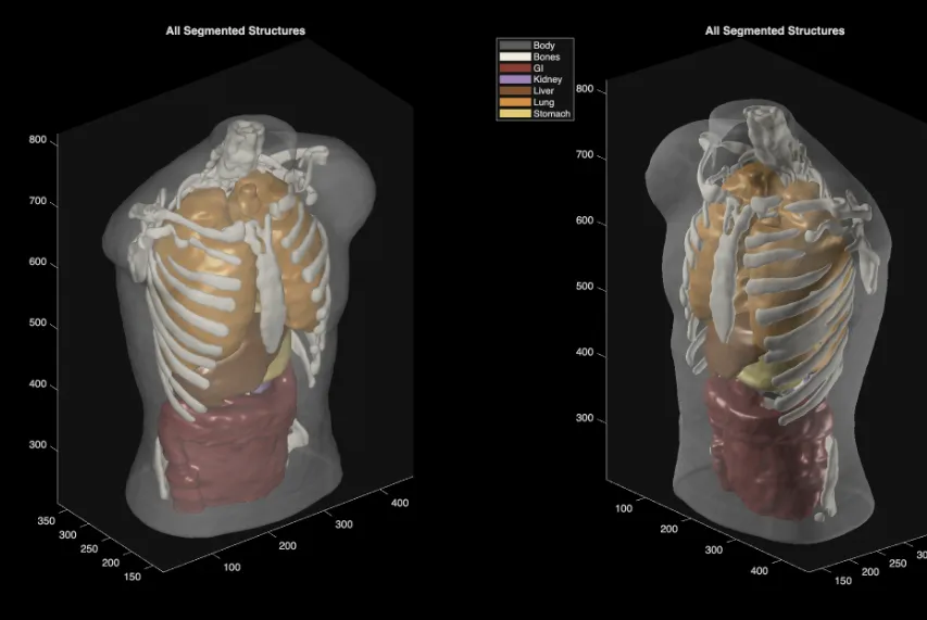 Body image scan renderings from Midjourney.